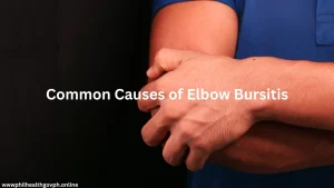 Common Causes of Elbow Bursitis