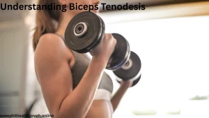 Understanding Biceps Tenodesis