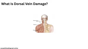 What Is Dorsal Vein Damage