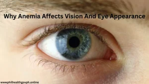 Why Anemia Affects Vision And Eye Appearance