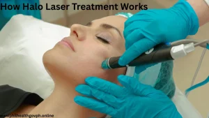 How Halo Laser Treatment Works