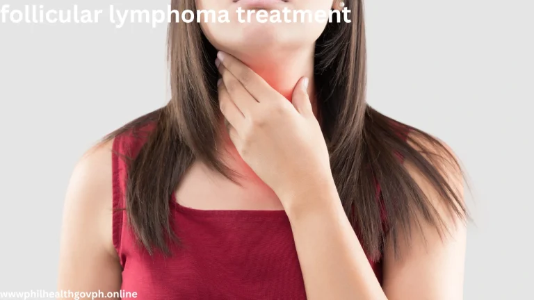 follicular lymphoma treatment